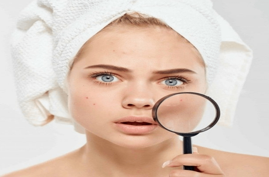 چگونه بدون عمل جراحی بینی گوشتی را کوچک کنیم؟ 3 چگونه بدون عمل جراحی بینی گوشتی را کوچک کنیم؟