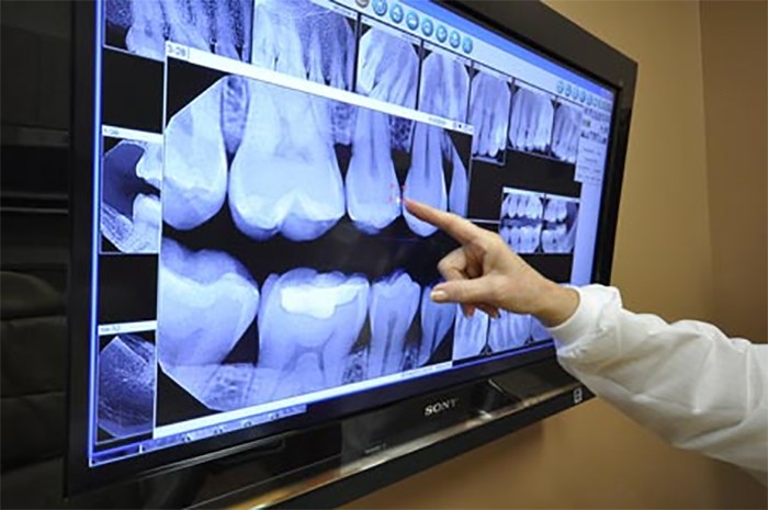 رپورتاژ: رادیولوژی در شمال تهران 4 اسکن cbct