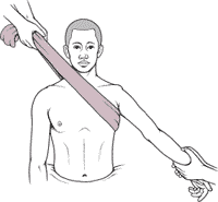دررفتگی شانه دررفتگی شانه