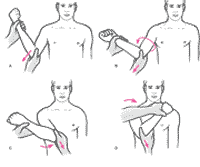 دررفتگی شانه دررفتگی شانه