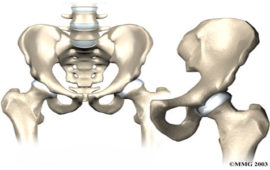 Hip joint