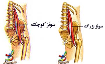 عضلات موثر بر حرکات مفصل ران 19 psoas