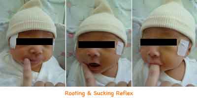 rooting-reflex-13069_2 rooting reflex 13069 2