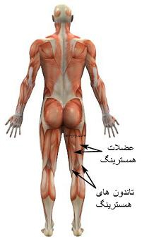 تاندونیت همسترینگ 4 Hamstring Tendonitis - Tendinosis