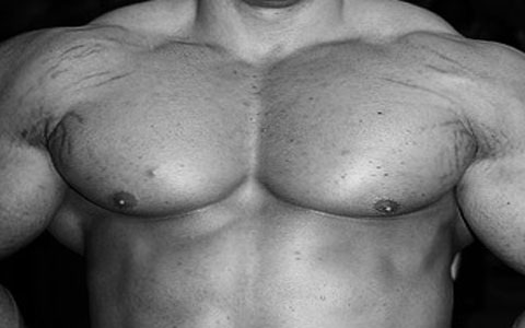ترک های پوست سینه 3 Stretch-Marks-on-the-Breasts-