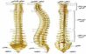 Spine