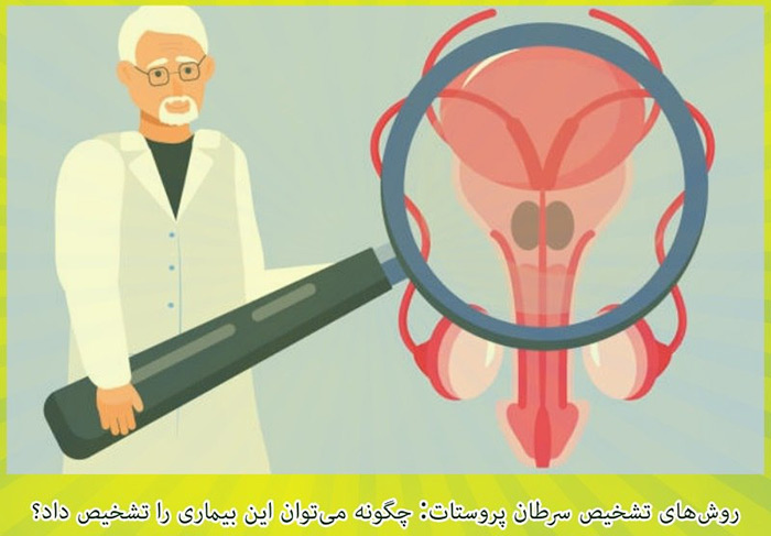 آیا شما هم در معرض خطر سرطان پروستات هستید؟ 5 سرطان پروستات