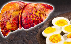 تخم مرغ برای کبد چرب