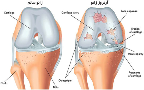 با افزایش سن پاها چه تغییری میکنند و این تغییرات چه تاثیری روی تمرینات میگذارد؟ 5 با افزایش سن پاها چه تغییری میکنند و این تغییرات چه تاثیری روی تمرینات میگذارد؟