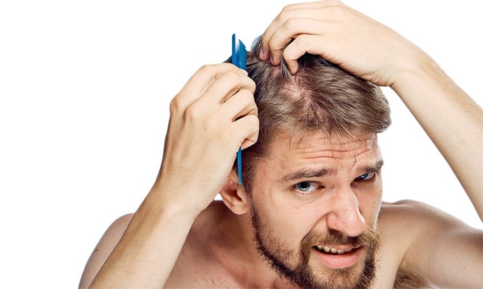 علت ریزش مو در کاهش وزن و روش جلوگیری از آن 8 کاهش وزن و ریزش مو