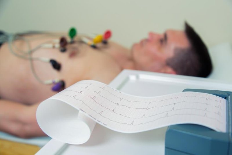 علائم ضربان قلب خطرناک - چه ضربان قلبی خطرناک است؟ 7 علائم ضربان قلب خطرناک - چه ضربان قلبی خطرناک است؟