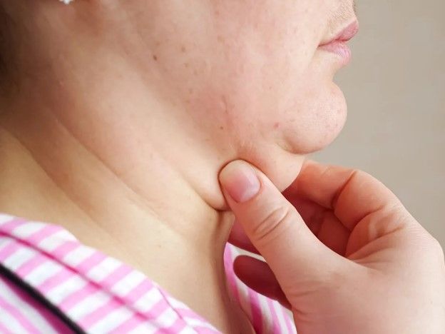 سریع ترین روش رفع افتادگی پوست صورت پس از رژیم های لاغری و کاهش وزن 5 رفع افتادگی پوست صورت