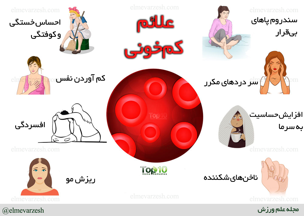 چگونه بدانیم کمبود آهن داریم؟ علائم و نشانههای کمبود آهن 5 چگونه بدانیم کمبود آهن داریم؟ علائم و نشانههای کمبود آهن