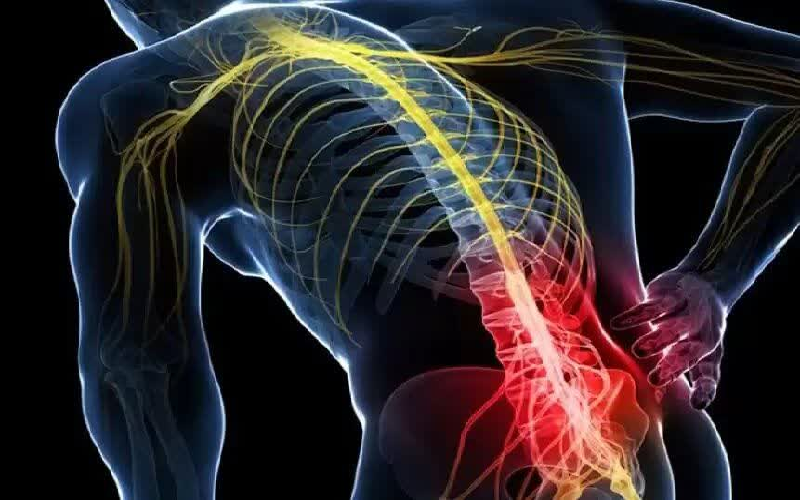 دیسک کمر به کجای پا میزند؟ 5 word image 63672 2 1
