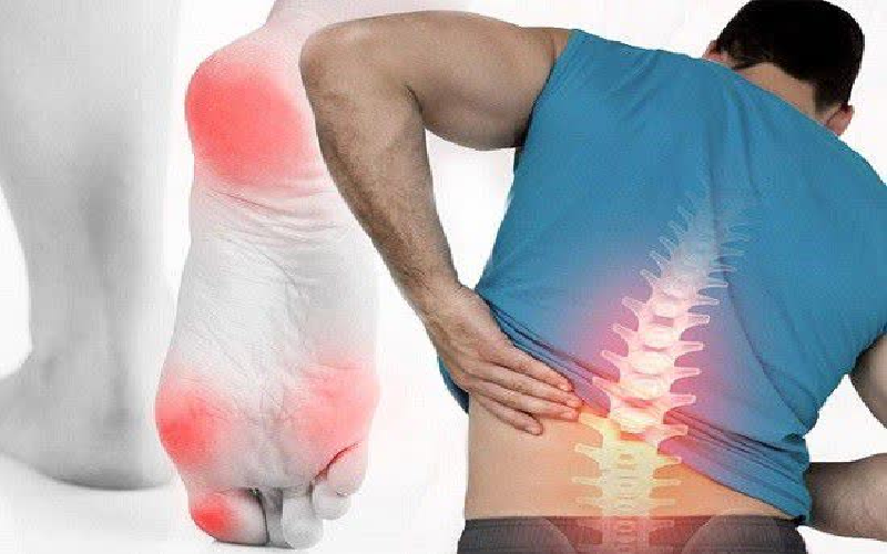 دیسک کمر به کجای پا میزند؟ 6 word image 63672 3 1