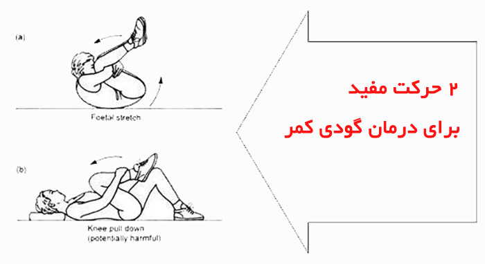 علت گودی کمر چیست؟ درمان گودی کمر با ورزش و حرکات اصلاحی 15 گودی کمر چیست و چگونه گودی کمر را درمان کنید؟